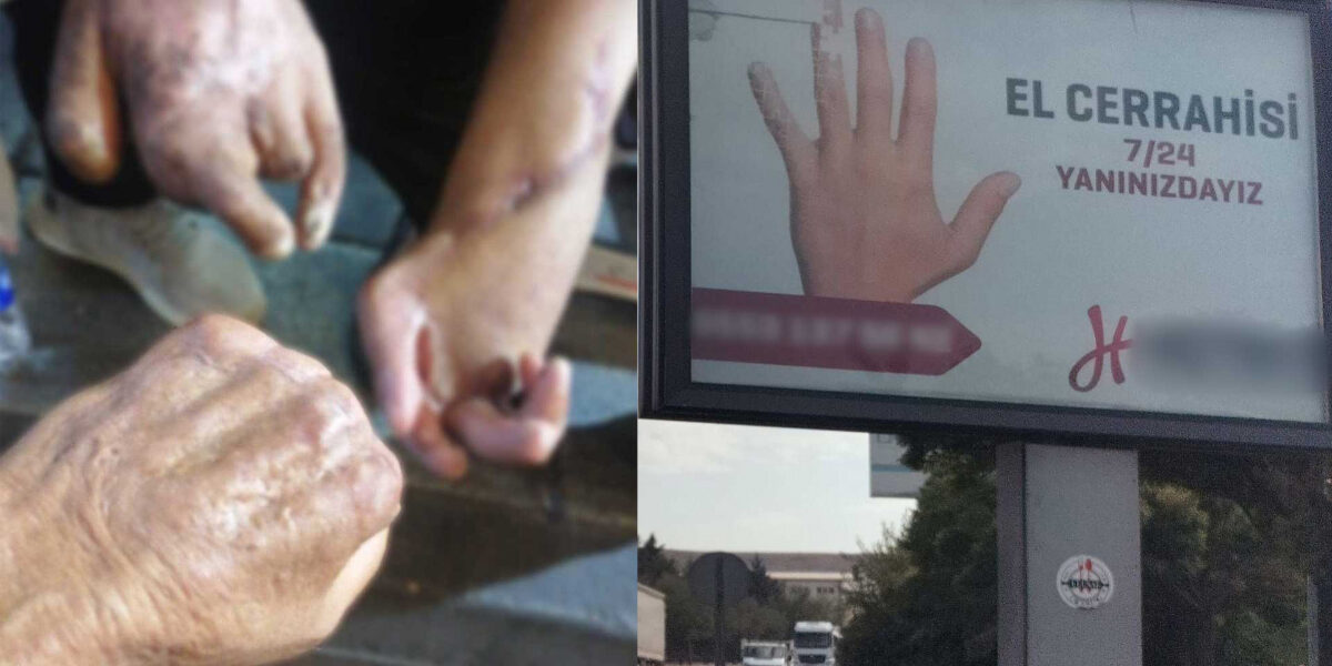 Karaca: Gaziantep’te iş kazaları patron–özel hastane düzeni ile örtbas ediliyor