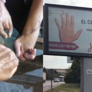 Karaca: Gaziantep’te iş kazaları patron–özel hastane düzeni ile örtbas ediliyor